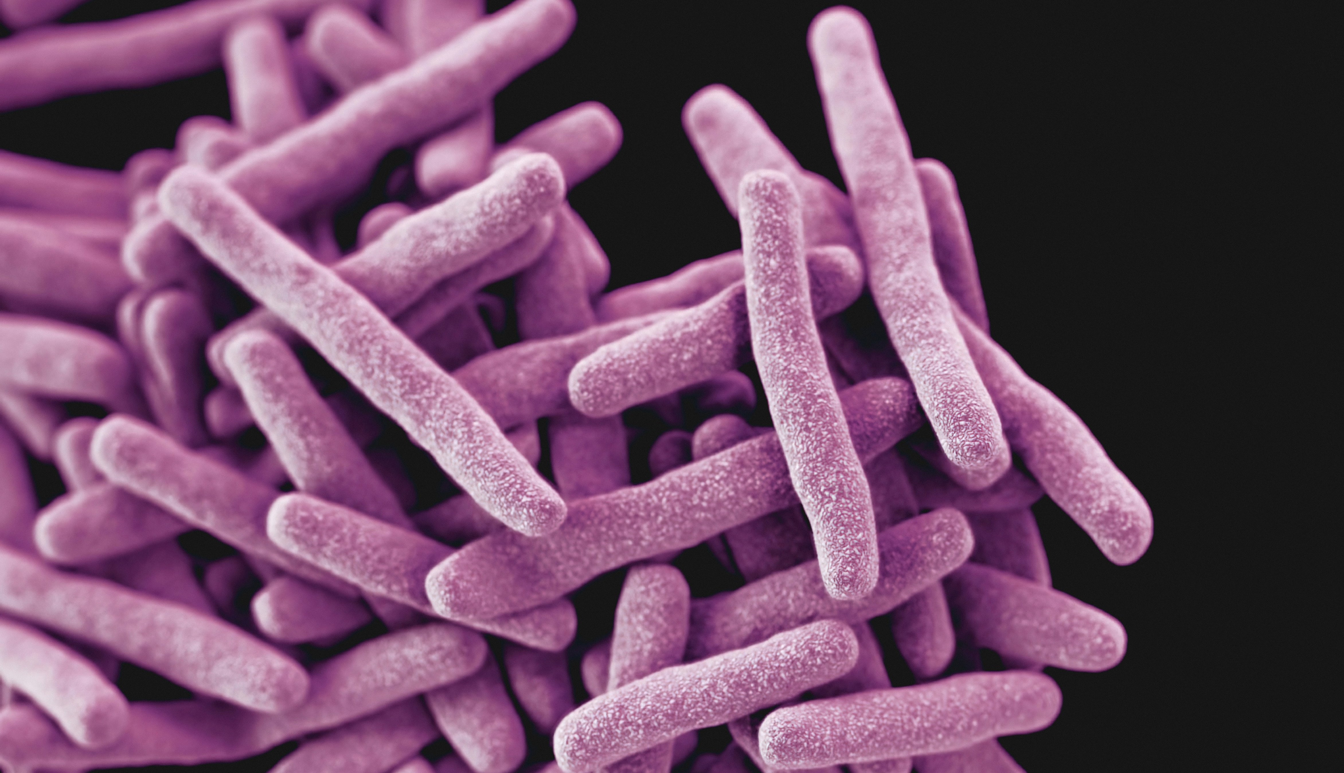 Has consumido billones de probióticos, ¿Pero para que sirven?